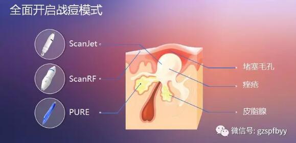 暑期“戰(zhàn)痘”鉅惠來襲，千萬別錯(cuò)過！內(nèi)附治療前后對比圖哦！5.jpg