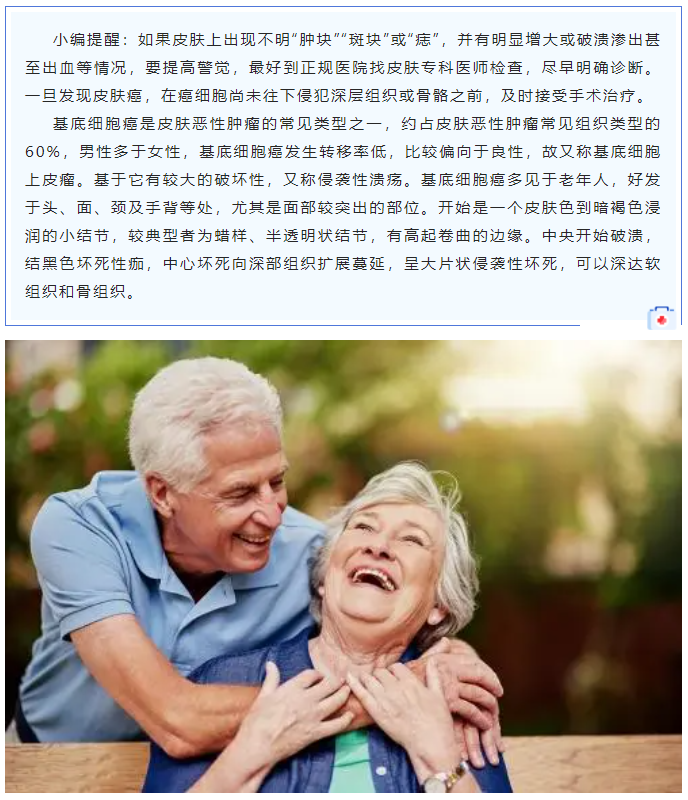 臉上的小黑點(diǎn)竟然是皮膚癌？3.png